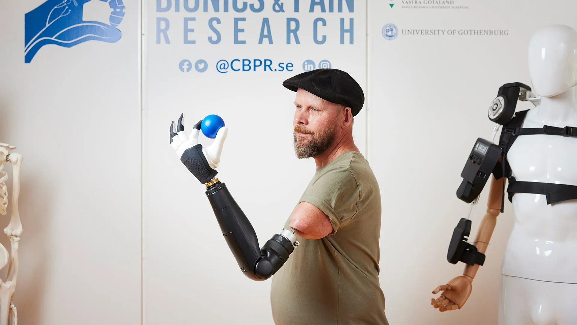 Haptic Feedback in Prosthetics